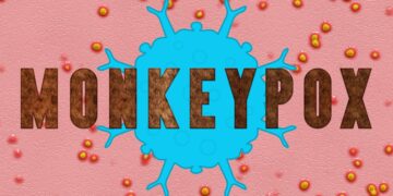 Monkeypox Virus